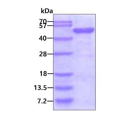 SDS-PAGE: Recombinant Human SNX1 His Protein [NBP1-48347]